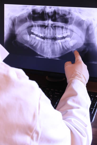 Best Emergency Broken Tooth Repair in Scottsbluff, NE